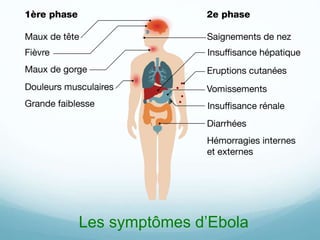 Les symptômes d’Ebola
 