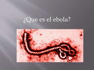 ¿Que es el ebola?
 