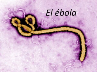 El ébola
 