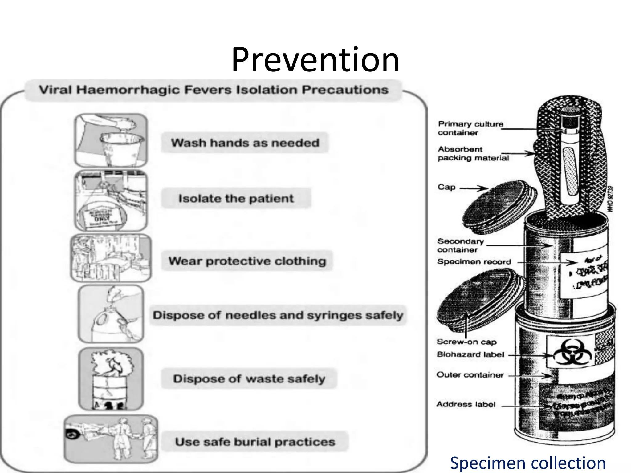 Prevention
Specimen collection
 