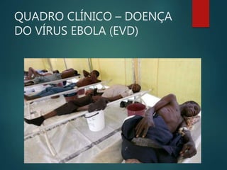QUADRO CLÍNICO – DOENÇA
DO VÍRUS EBOLA (EVD)
 