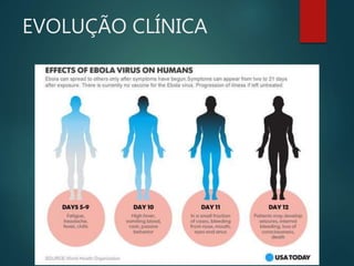 EVOLUÇÃO CLÍNICA
 