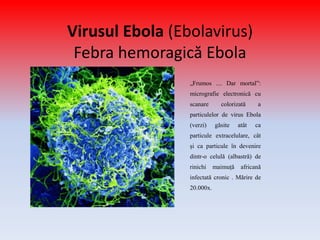 Virusul Ebola (Ebolavirus)
Febra hemoragică Ebola
„Frumos .... Dar mortal”:
micrografie electronică cu
scanare colorizată a
particulelor de virus Ebola
(verzi) găsite atât ca
particule extracelulare, cât
și ca particule în devenire
dintr-o celulă (albastră) de
rinichi maimuță africană
infectată cronic . Mărire de
20.000x.
 