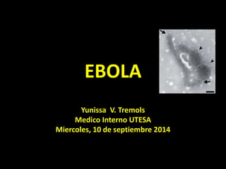 EBOLA 
Yunissa V. Tremols 
Medico Interno UTESA 
Miercoles, 10 de septiembre 2014 
 