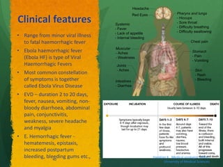 Clinical features
• Range from minor viral illness
to fatal haemorrhagic fever
• Ebola haemorrhagic fever
(Ebola HF) is type of Viral
Haemorrhagic Fevers
• Most common constellation
of symptoms is together
called Ebola Virus Disease
• EVD – duration 2 to 20 days,
fever, nausea, vomiting, non-
bloody diarrhoea, abdominal
pain, conjunctivitis,
weakness, severe headache
and myalgia
• E. Hemorrhagic fever -
hematemesis, epistaxis,
increased postpartum
bleeding, bleeding gums etc., Haratian K. ,Medical virologist, Alborz
University of Medical Sciences
40
 