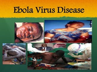 Ebola Virus Disease
 