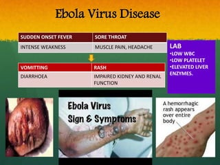 Ebola Virus Disease
SUDDEN ONSET FEVER SORE THROAT
INTENSE WEAKNESS MUSCLE PAIN, HEADACHE
VOMITTING RASH
DIARRHOEA IMPAIRED KIDNEY AND RENAL
FUNCTION
LAB
•LOW WBC
•LOW PLATELET
•ELEVATED LIVER
ENZYMES.
 