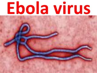 Ebola virus
 