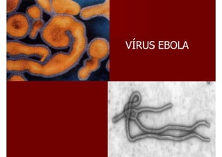 Ebola virus
