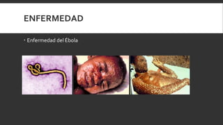 ENFERMEDAD
 Enfermedad del Ébola
 