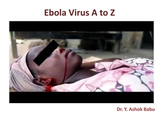 Ebola Virus A to Z
Dr. Y. Ashok Babu
 