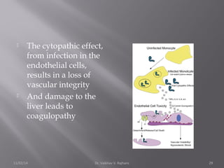  The cytopathic effect, 
from infection in the 
endothelial cells, 
results in a loss of 
vascular integrity 
 And damage to the 
liver leads to 
coagulopathy 
11/02/14 Dr. Vaibhav V. Rajhans 29 
 