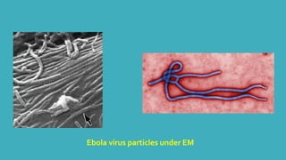 Ebola virus particles under EM 
 