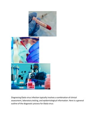 Diagnosing Ebola virus infection typically involves a combination of clinical
assessment, laboratory testing, and epidemiological information. Here is a general
outline of the diagnostic process for Ebola virus:
 