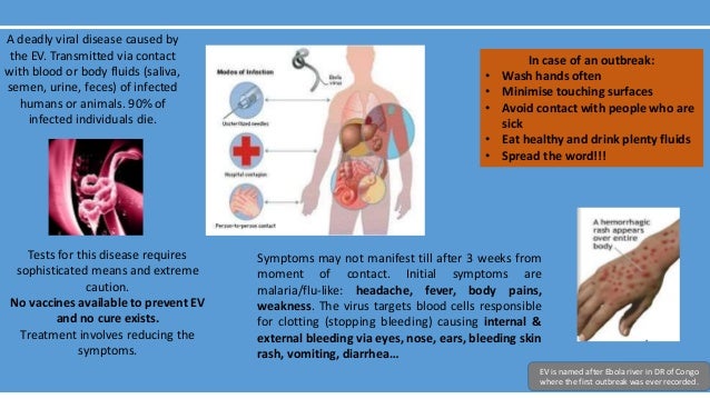 ebola-virus-ev