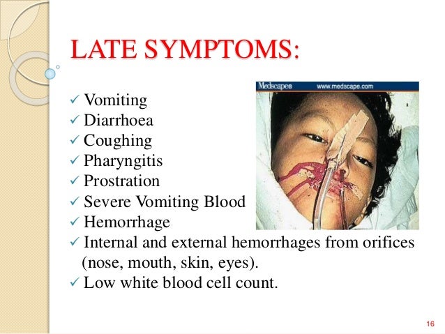 Ebola virus ppt
