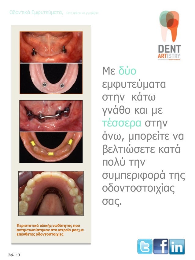 οδοντοστοιχίες ιστοσελίδα datingPZ 38 na συμπαίκτη