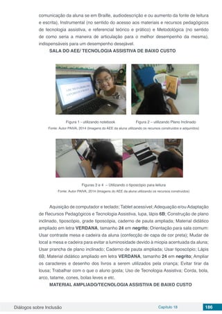 Diálogos sobre Inclusão Capítulo 18 186
comunicação da aluna se em Braille, audiodescrição e ou aumento da fonte de leitura
e escrita), Instrumental (no sentido do acesso aos materiais e recursos pedagógicos
de tecnologia assistiva, e referencial teórico e prático) e Metodológica (no sentido
de como seria a maneira de articulação para o melhor desempenho da mesma),
indispensáveis para um desempenho desejável.
SALA DO AEE/ TECNOLOGIA ASSISTIVA DE BAIXO CUSTO
Figura 1 - utilizando notebook Figura 2 – utilizando Plano Inclinado
Fonte: Autor PAIVA, 2014 (Imagens do AEE da aluna utilizando os recursos construídos e adquiridos)
Figuras 3 e 4 – Utilizando o tiposcópio para leitura
Fonte: Autor PAIVA, 2014 (Imagens do AEE da aluna utilizando os recursos construídos)
Aquisição de computador e teclado; Tablet acessível; Adequação e/ou Adaptação
de Recursos Pedagógicos e Tecnologia Assistiva, lupa, lápis 6B; Construção de plano
inclinado, tiposcópio, grade tiposcópia, caderno de pauta ampliada; Material didático
ampliado em letra VERDANA, tamanho 24 em negrito; Orientação para sala comum:
Usar contraste mesa e cadeira da aluna (confecção de capa de cor preta); Mudar de
local a mesa e cadeira para evitar a luminosidade devido à miopia acentuada da aluna;
Usar prancha de plano inclinado; Caderno de pauta ampliada; Usar tiposcópio; Lápis
6B; Material didático ampliado em letra VERDANA, tamanho 24 em negrito; Ampliar
os caracteres e desenho dos livros a serem utilizados pela criança; Evitar tirar da
lousa; Trabalhar com o que o aluno gosta; Uso de Tecnologia Assistiva; Corda, bola,
arco, tatame, cones, bolas leves e etc.
MATERIAL AMPLIADO/TECNOLOGIA ASSISTIVA DE BAIXO CUSTO
 