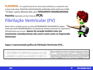 19 www.ibraph.com.br
FLAVINHA – É a caçulinha da turma. Ama música eletrônica, e sempre foi uma
criança muito ativa. Flavinha é extremamente acelerada assim como seu irmão
“Tá Veloz”, porém diferente dele, ela é TOTALMENTE DESORGANIZADA.
Flavinha representa um dos ritmos de PCR:
Fibrilação Ventricular (FV)
Neste ritmo o coração assume um ritmo EXTREMAMENTE ACELERADO de origem
ventricular porém DESORGANIZADO. As frequências Cardíaca costumam ser superiores a
250 batimentos por minuto. Apesar do coração também estar em
movimento o bombeamento não ocorre assim como na Taquicardia
Ventricular.
Segue a representação gráfica da Fibrilação Ventricular (FV)...
2015
 