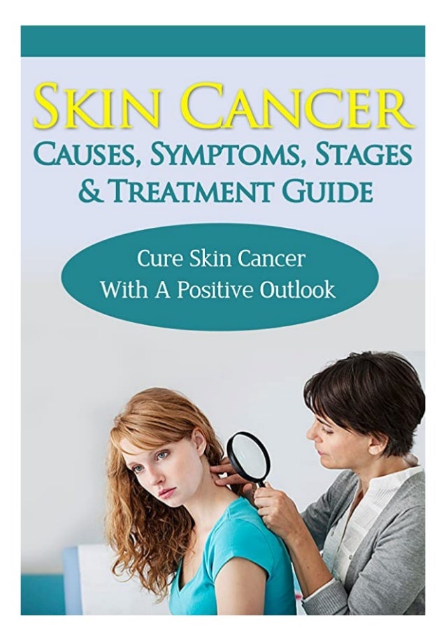 [Ebook] Skin Cancer Causes Symptoms Stages & Treatment Guide Cure Skin