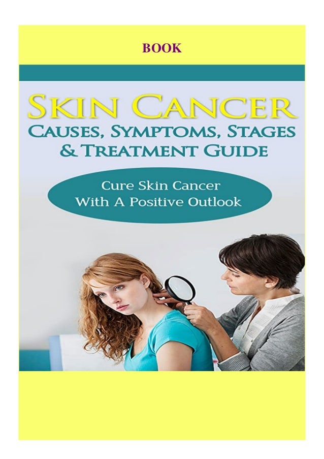 [Ebook] Skin Cancer Causes Symptoms Stages & Treatment Guide Cure Skin