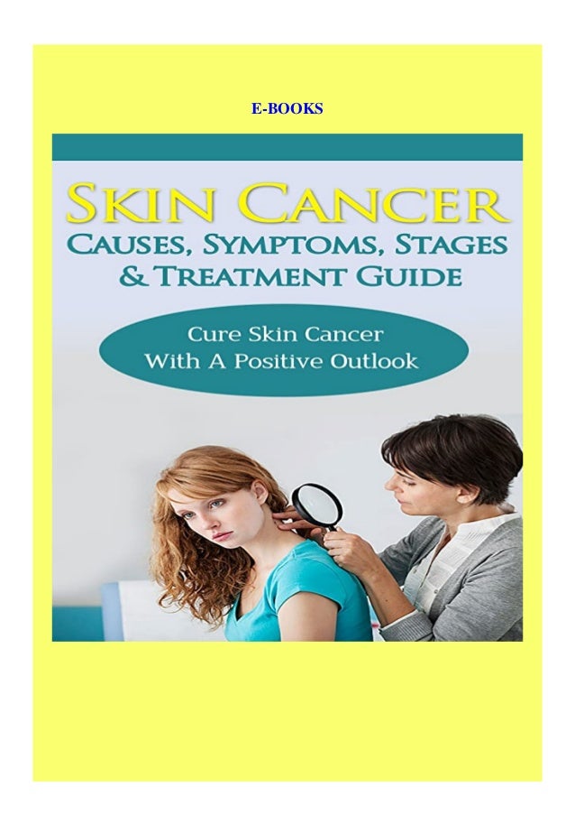 [Ebook] Skin Cancer Causes Symptoms Stages & Treatment Guide Cure Skin
