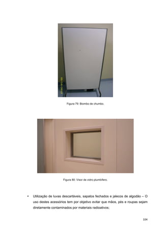   104	
  
Figura 79: Biombo de chumbo.
Figura 80: Visor de vidro plumbífero.
• Utilização de luvas descartáveis, sapatos fechados e jalecos de algodão – O
uso destes acessórios tem por objetivo evitar que mãos, pés e roupas sejam
diretamente contaminados por materiais radioativos;
 