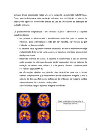   2	
  
fármaco. Desta associação nasce um novo composto, denominado radiofármaco.
Como este radiofármaco emite radiação ionizante, sua distribuição no interior do
corpo pode agora ser identificada através do uso de um sistema de detecção de
radiação ionizante.
Os procedimentos diagnósticos - em Medicina Nuclear - obedecem à seguinte
sequência básica:
• Ao paciente é administrado o radiofármaco específico para o estudo de
interesse. Essa administração pode ser por ingestão, por injeção ou por
inalação, conforme o estudo;
• O paciente deve aguardar o tempo necessário até que o radiofármaco seja
metabolizado. Este tempo varia conforme o estudo de interesse, podendo ser
de algumas horas;
• Decorrido o tempo de espera, o paciente é encaminhado à sala de exames
onde as áreas de interesse do corpo serão “scaneadas” por um detector de
radiação. O sistema mais utilizado é o de gamma câmaras, conforme pode
ser visto no capítulo MN-4;
• As informações obtidas pelo detector são transmitidas para um poderoso
sistema computacional que transforma os sinais obtidos em imagens. Como o
sistema de detecção faz uso de detectores de cintilação, as imagens obtidas
são usualmente denominadas cintilografias.
Apresentamos a seguir algumas imagens ilustrativas:
Esta	
  é	
  uma	
  imagem	
  tomográfica	
  de	
  
um	
  estudo	
  cerebral.	
  
 