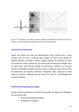   48	
  
	
  
	
  
Figura 33 - Esquema do pulso elétrico cardíaco, imagens de cintilografia do ventrículo com ECG na
diástole e na sístole e gráfico da variação de volume do ventrículo esquerdo.
Varreduras de corpo inteiro
Apesar dos campos de visão das gama-câmaras serem menores que o corpo
humano como um todo, é possível obter imagens do corpo inteiro através de
algumas técnicas. Uma delas é realizar imagens estáticas de cada parte do corpo
em sequencia e depois juntá-las em uma matriz maior formando uma imagem única
do corpo inteiro. Outra técnica consiste em movimentar o detector ou a mesa de
exame em velocidade constante de modo a obter a imagem do corpo inteiro ao final
do comprimento do paciente. Exemplos: cintilografia óssea, pesquisa de corpo
inteiro com Gálio-67, pesquisa de corpo inteiro com Iodo-131, Linfocintilografia de
membros inferiores.
Parâmetros De Aquisição De Imagem
Existem diversos parâmetros de controle da aquisição da imagem em cintilografia.
Os mais comuns são:
• Tempo de aquisição da projeção
• Quantidade de contagem
 