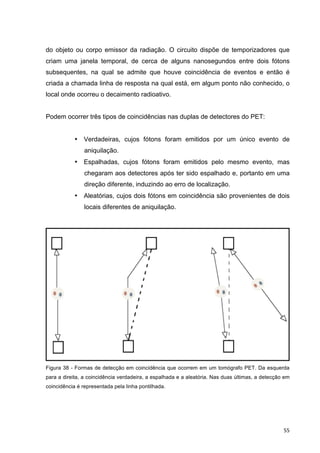   55	
  
do objeto ou corpo emissor da radiação. O circuito dispõe de temporizadores que
criam uma janela temporal, de cerca de alguns nanosegundos entre dois fótons
subsequentes, na qual se admite que houve coincidência de eventos e então é
criada a chamada linha de resposta na qual está, em algum ponto não conhecido, o
local onde ocorreu o decaimento radioativo.
Podem ocorrer três tipos de coincidências nas duplas de detectores do PET:
• Verdadeiras, cujos fótons foram emitidos por um único evento de
aniquilação.
• Espalhadas, cujos fótons foram emitidos pelo mesmo evento, mas
chegaram aos detectores após ter sido espalhado e, portanto em uma
direção diferente, induzindo ao erro de localização.
• Aleatórias, cujos dois fótons em coincidência são provenientes de dois
locais diferentes de aniquilação.
	
  
Figura 38 - Formas de detecção em coincidência que ocorrem em um tomógrafo PET. Da esquerda
para a direita, a coincidência verdadeira, a espalhada e a aleatória. Nas duas últimas, a detecção em
coincidência é representada pela linha pontilhada.
 