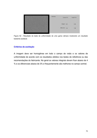   75	
  
• Aquisição com baixa contagem (teste diário) corrig
• Aquisição com baixa contagem (teste diário) corrigida
Figura 52 - Resultado do teste de uniformidade de uma gama câmara mostrando um resultado
bastante aceitável.
Critérios de aceitação
A imagem deve ser homogênea em todo o campo de visão e os valores de
uniformidade de acordo com os resultados obtidos nos testes de referência ou das
recomendações do fabricante. No geral os valores integrais devem ficar abaixo de 4
% e os diferenciais abaixo de 3% e frequentemente são melhores no campo central.
 