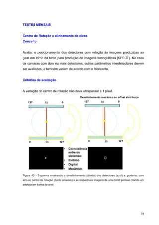   78	
  
TESTES MENSAIS
Centro de Rotação e alinhamento de eixos
Conceito
Avaliar o posicionamento dos detectores com relação às imagens produzidas ao
girar em torno da fonte para produção de imagens tomográficas (SPECT). No caso
de camaras com dois ou mais detectores, outros parâmetros interdetectores devem
ser avaliados, e também variam de acordo com o fabricante.
Critérios de aceitação
A variação do centro de rotação não deve ultrapassar ± 1 pixel.
• Coincidência
entre os
sistemas:
• Elétrico
• Digital
• Mecânico
127 065
0 12765
127 065
0 12765
Desalinhamento mecânico ou offset eletrônico
Figura 55 - Esquema mostrando o desalinhamento (direita) dos detectores (azul) e, portanto, com
erro no centro de rotação (ponto amarelo) e as respectivas imagens de uma fonte pontual criando um
artefato em forma de anel.
 