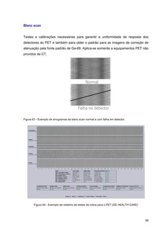  88	
  
Blanc scan
Testes e calibrações necessárias para garantir a uniformidade de resposta dos
detectores do PET e também para obter o padrão para as imagens de correção de
atenuação pela fonte padrão de Ge-68. Aplica-se somente a equipamentos PET não
providos de CT.
Figura 63 - Exemplo de sinogramas de blanc scan normal e com falha em detector.
Figura 64 - Exemplo de relatório de testes de rotina para o PET (GE HEALTH CARE)
 