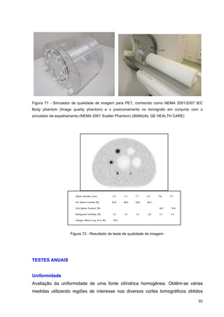   95	
  
	
  	
   	
  
Figura 71 - Simulador de qualidade de imagem para PET, conhecido como NEMA 2001/2007 IEC
Body phantom (Image quality phantom) e o posicionamento no tomógrafo em conjunto com o
simulador de espalhamento (NEMA 2001 Scatter Phantom) (MANUAL GE HEALTH CARE)
	
  
Figura 72 - Resultado de teste de qualidade de imagem.
TESTES ANUAIS
Uniformidade
Avaliação da uniformidade de uma fonte cilíndrica homogênea. Obtêm-se várias
medidas utilizando regiões de interesse nos diversos cortes tomográficos obtidos
 