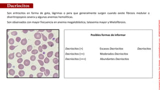 Son eritrocitos en forma de gota, lágrimas o pera que generalmente surgen cuando existe fibrosis medular o
diseritropoyesis severa y algunas anemias hemolíticas.
Son observados con mayor frecuencia en anemia megaloblástica, talasemia mayor y Mielofibrosis.
Dacriocitos
Posibles formas de informar
Dacriocitos (+) Escasos Dacriocitos Dacriocitos
Dacriocitos (++) Moderados Dacriocitos
Dacriocitos (+++) Abundantes Dacriocitos
Licensed
to
Remberto
Cari
Hojeda
-
carihojeda@gmail.com
-
HP46816324875423
 