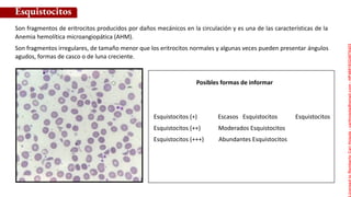 Son fragmentos de eritrocitos producidos por daños mecánicos en la circulación y es una de las características de la
Anemia hemolítica microangiopática (AHM).
Son fragmentos irregulares, de tamaño menor que los eritrocitos normales y algunas veces pueden presentar ángulos
agudos, formas de casco o de luna creciente.
Esquistocitos
Posibles formas de informar
Esquistocitos (+) Escasos Esquistocitos Esquistocitos
Esquistocitos (++) Moderados Esquistocitos
Esquistocitos (+++) Abundantes Esquistocitos
Licensed
to
Remberto
Cari
Hojeda
-
carihojeda@gmail.com
-
HP46816324875423
 