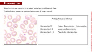 Posibles formas de informar
Son eritrocitos que muestran en su región central una hendidura más clara.
Ocasionalmente pueden ser vistos en la distensión de sangre normal.
Estomatocitos
Estomatocitos (+) Escasos Estomatocitos Estomatocitos
Estomatocitos (++) Moderados Estomatocitos
Estomatocitos (+++) Abundantes Estomatocitos
Licensed
to
Remberto
Cari
Hojeda
-
carihojeda@gmail.com
-
HP46816324875423
 