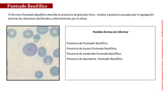 Posibles formas de informar
El término Punteado Basofilico describe la presencia de gránulos finos , medios o groseros causados por la agregación
anormal de ribosomas distribuidos uniformemente por la célula.
Punteado Basofílico
Presencia de Punteado Basofílico.
Presencia de escaso Punteado Basofílico.
Presencia de moderado Punteado Basofílico.
Presencia de abundante Punteado Basofílico.
Licensed
to
Remberto
Cari
Hojeda
-
carihojeda@gmail.com
-
HP46816324875423
 