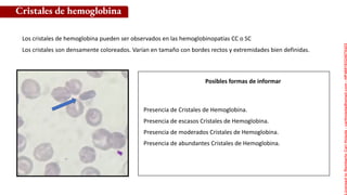 Posibles formas de informar
Los cristales de hemoglobina pueden ser observados en las hemoglobinopatías CC o SC
Los cristales son densamente coloreados. Varían en tamaño con bordes rectos y extremidades bien definidas.
Cristales de hemoglobina
Presencia de Cristales de Hemoglobina.
Presencia de escasos Cristales de Hemoglobina.
Presencia de moderados Cristales de Hemoglobina.
Presencia de abundantes Cristales de Hemoglobina.
Licensed
to
Remberto
Cari
Hojeda
-
carihojeda@gmail.com
-
HP46816324875423
 