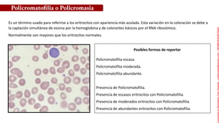 Posibles formas de reportar
Es un término usado para referirse a los eritrocitos con apariencia más azulada. Esta variación en la coloración se debe a
la captación simultánea de eosina por la hemoglobina y de colorantes básicos por el RNA ribosómico.
Normalmente son mayores que los eritrocitos normales.
Policromatofilia o Policromasia
Policromatofilia escasa.
Policromatofilia moderada.
Policromatofilia abundante.
Presencia de Policromatofilia.
Presencia de escasos eritrocitos con Policromatofilia.
Presencia de moderados eritrocitos con Policromatofilia.
Presencia de abundantes eritrocitos con Policromatofilia.
Licensed
to
Remberto
Cari
Hojeda
-
carihojeda@gmail.com
-
HP46816324875423
 