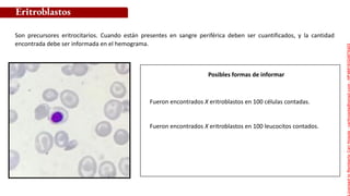 Posibles formas de informar
Fueron encontrados X eritroblastos en 100 células contadas.
Fueron encontrados X eritroblastos en 100 leucocitos contados.
Eritroblastos
Son precursores eritrocitarios. Cuando están presentes en sangre periférica deben ser cuantificados, y la cantidad
encontrada debe ser informada en el hemograma.
Licensed
to
Remberto
Cari
Hojeda
-
carihojeda@gmail.com
-
HP46816324875423
 