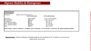 Algunos Modelos de Hemograma
Observaciones : Examen realizado y corregido luego de una incubación a 37 °C debido a la presencia de
aglutinación eritrocitaria.
Licensed
to
Remberto
Cari
Hojeda
-
carihojeda@gmail.com
-
HP46816324875423
 