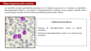 Posibles formas de informar
Los neutrófilos normales, generalmente presentan de 3 a 4 lóbulos (raramente de 2 a 5 lóbulos). Los Neutrófilos
hipersegmentados exhiben 5 o más lóbulos. La hipersegmentación es definida cuando cualquier neutrófilo exhibe
más de 6 lóbulos o cuando más del 3% de los neutrófilos presentan más de 5 lóbulos.
Hipersegmentación nuclear
Presencia de hipersegmentación nuclear en algunos
neutrófilos.
Presencia de hipersegmentación nuclear en la mayoría de los
neutrófilos.
Licensed
to
Remberto
Cari
Hojeda
-
carihojeda@gmail.com
-
HP46816324875423
 