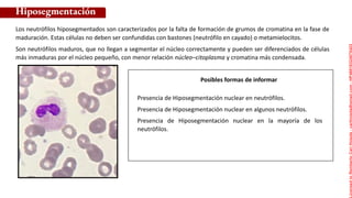 Posibles formas de informar
Presencia de Hiposegmentación nuclear en neutrófilos.
Presencia de Hiposegmentación nuclear en algunos neutrófilos.
Presencia de Hiposegmentación nuclear en la mayoría de los
neutrófilos.
Los neutrófilos hiposegmentados son caracterizados por la falta de formación de grumos de cromatina en la fase de
maduración. Estas células no deben ser confundidas con bastones (neutrófilo en cayado) o metamielocitos.
Son neutrófilos maduros, que no llegan a segmentar el núcleo correctamente y pueden ser diferenciados de células
más inmaduras por el núcleo pequeño, con menor relación núcleo–citoplasma y cromatina más condensada.
Hiposegmentación
Licensed
to
Remberto
Cari
Hojeda
-
carihojeda@gmail.com
-
HP46816324875423
 