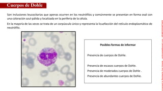 Posibles formas de informar
Son inclusiones leucocitarias que apenas ocurren en los neutrófilos y comúnmente se presentan en forma oval con
una coloración azul-pálida y localizada en la periferia de la célula.
En la mayoría de las veces se trata de un corpúsculo único y representa la licuefacción del retículo endoplasmático de
neutrófilo.
Cuerpos de Dohle
Presencia de cuerpos de Dohle.
Presencia de escasos cuerpos de Dohle.
Presencia de moderados cuerpos de Dohle .
Presencia de abundantes cuerpos de Dohle.
Licensed
to
Remberto
Cari
Hojeda
-
carihojeda@gmail.com
-
HP46816324875423
 