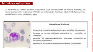Posibles formas de informar
Inclusiones azul-verdoso
Las inclusiones azul- verdoso presentes en neutrófilos y que también pueden ser vistos en monocitos, son
inclusiones encontradas en pacientes debilitados con enfermedades hepáticas e injuria tecidual grave, siendo
vistos también en cáncer metastático y sepsis.
Presencia de inclusiones azul-verdoso en raros neutrófilos y/o monocitos.
Presencia de escasas inclusiones azul-verdoso en neutrófilos y/o
monocitos.
Presencia de moderadas/abundantes inclusiones azul-verdoso en
neutrófilos y/o monocitos.
Presencia de inclusiones azul-verdoso en neutrófilos y/o monocitos.
Licensed
to
Remberto
Cari
Hojeda
-
carihojeda@gmail.com
-
HP46816324875423
 