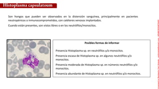 Posibles formas de informar
Histoplasma capsulatoum
Son hongos que pueden ser observados en la distensión sanguínea, principalmente en pacientes
neutropénicos o inmunocomprometidos, con catéteres venosos implantados.
Cuando están presentes, son vistos libres o en los neutrófilos/monocitos.
Presencia Histoplasma sp. en neutrófilos y/o monocitos.
Presencia escasa de Histoplasma sp. en algunos neutrófilos y/o
monocitos.
Presencia moderada de Histoplasma sp. en números neutrófilos y/o
monocitos.
Presencia abundante de Histoplasma sp. en neutrófilos y/o monocitos.
Licensed
to
Remberto
Cari
Hojeda
-
carihojeda@gmail.com
-
HP46816324875423
 