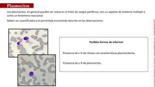 Posibles formas de informar
Los plasmocitos, en general pueden ser vistos en el frotis de sangre periférico, con un aspecto de mieloma múltiple o
como un fenómeno reaccional.
Deben ser cuantificados y el porcentaje encontrado descrito en las observaciones.
Plasmocitos
Presencia de x % de células con características plasmocitarias.
Presencia de x % de plasmocitos.
Licensed
to
Remberto
Cari
Hojeda
-
carihojeda@gmail.com
-
HP46816324875423
 