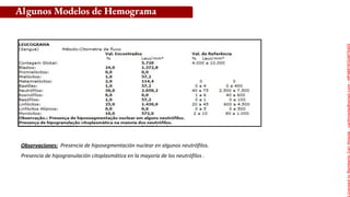 Observaciones: Presencia de hiposegmentación nuclear en algunos neutrófilos.
Presencia de hipogranulación citoplasmática en la mayoría de los neutrófilos .
Algunos Modelos de Hemograma
Licensed
to
Remberto
Cari
Hojeda
-
carihojeda@gmail.com
-
HP46816324875423
 