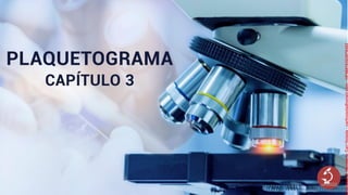 PLAQUETOGRAMA
CAPÍTULO 3
Licensed
to
Remberto
Cari
Hojeda
-
carihojeda@gmail.com
-
HP46816324875423
 